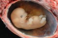 asi osm týdnů po početí, lunar caustic - Embryo, CC BY 2.0, simple.wikipedia.org